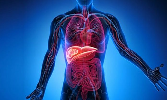 Karaciğer, vücudun en önemli detoks organlarından biridir ve sağlıklı çalışması genel sağlık açısından kritik bir rol oynar. Modern yaşamda işlenmiş gıdalar, alkol ve stres gibi faktörler karaciğerin yükünü artırabilir. Bu nedenle karaciğer temizleme diyeti, vücudu toksinlerden arındırmak, metabolizmayı desteklemek ve enerji seviyelerini yükseltmek için etkili bir yöntem olarak öne çıkıyor. Bu diyet, doğru uygulandığında hem besleyici hem de güvenli bir yaşam tarzı sağlar. Konulu bir haber görseli.